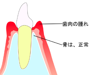 治療の工程