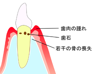 治療の工程
