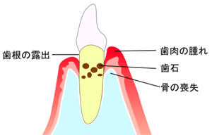 治療の工程
