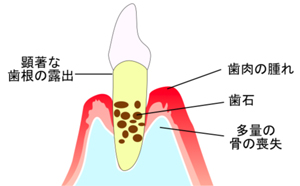 治療の工程
